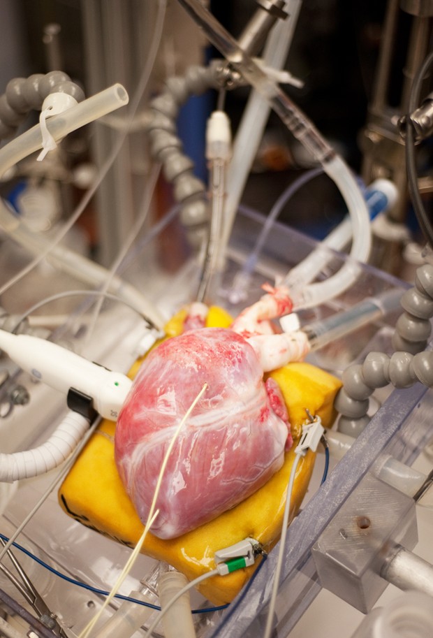 A pig heart is monitored in the Visible Heart Libratory. The experiment measured the effectiveness of pre-treating methods to give the heart added strength in the heart transplant process. 
