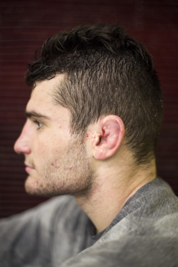 Sophomore Jake Short shows his cauliflower ear, a unique scar that is common among wrestlers. The scar forms upon traumatic impact to the ear, damaging cartilage, which then fills with fluid that can be drained. Short, who said he has been wrestling since he could walk, describes the cauliflower ear as a badge of honor and a symbol for the sacrifices that wrestlers make.